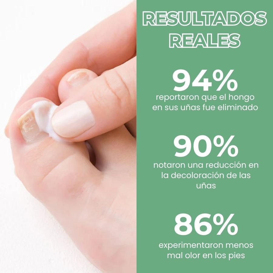 FungBoost™ | Gel para el Tratamiento de Hongos en las Uñas