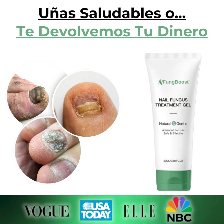FungBoost™ | Gel para el Tratamiento de Hongos en las Uñas