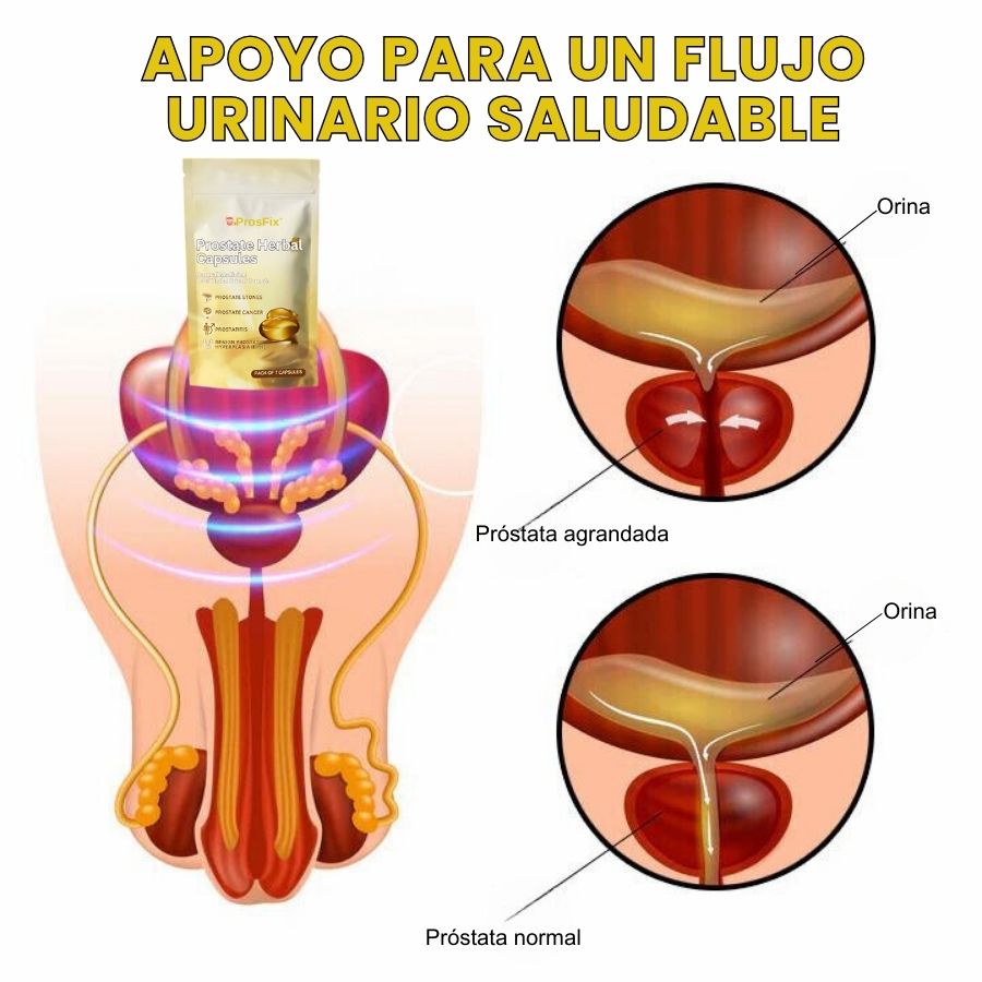 ProsFix™ | Cápsula Herbal para la Próstata