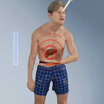 LiverRecovery™ | Gotas herbales para la limpieza del hígado