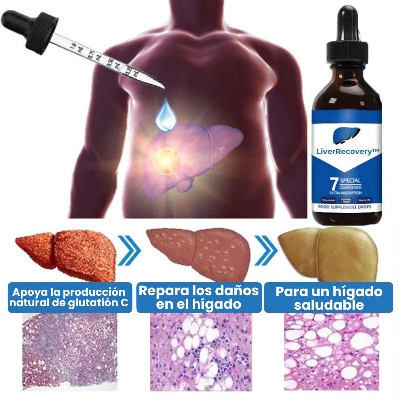 LiverRecovery™ | Gotas herbales para la limpieza del hígado